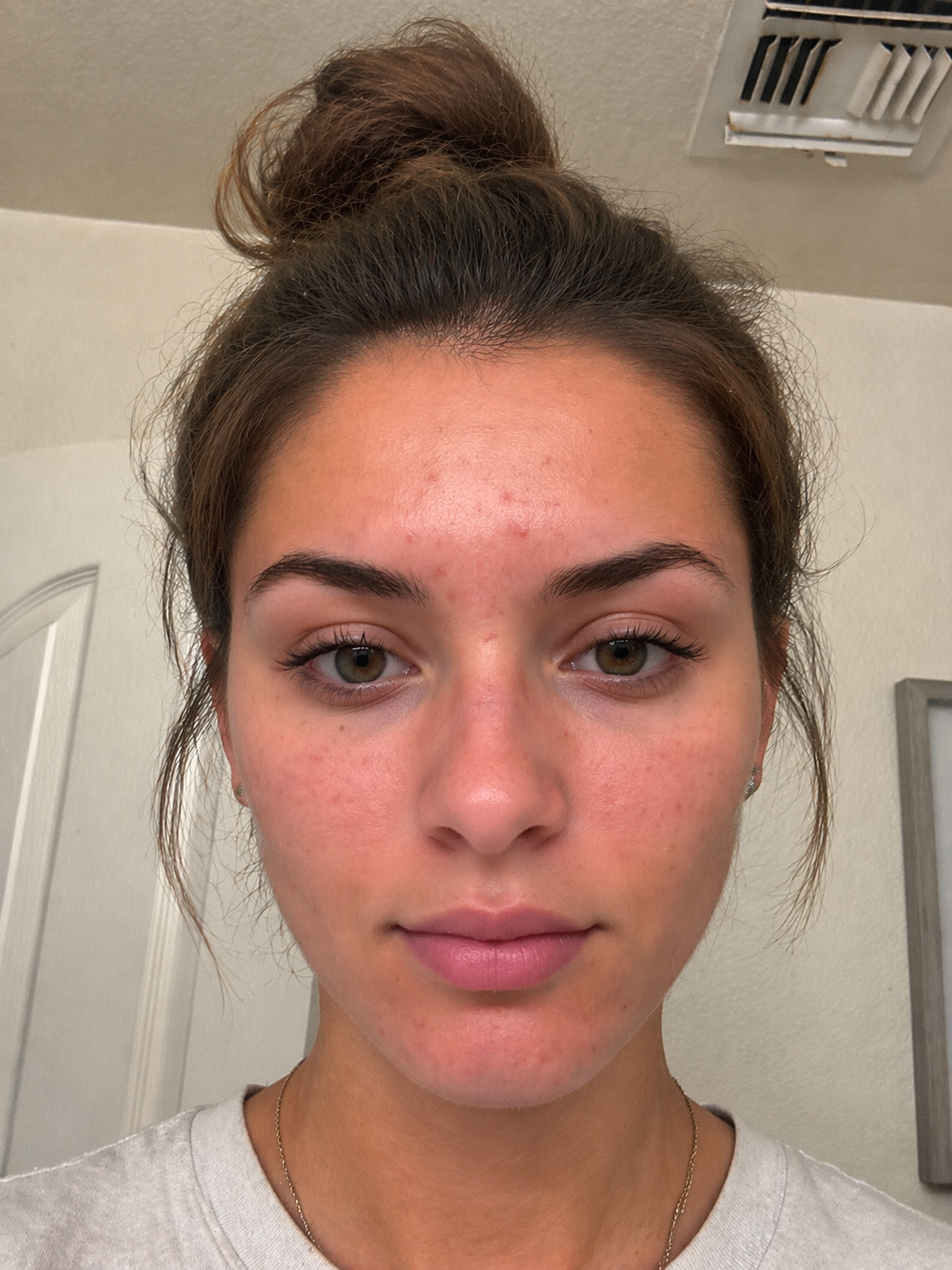 Front-facing skin scan capture example in a skincare app